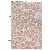 Solarbio K111611P Anti-ERC1 Polyclonal Antibody