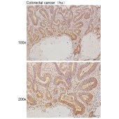 Solarbio K111614P Anti-ERC1 Polyclonal Antibody