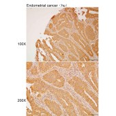 Solarbio K111919P Anti-NRBP1 Polyclonal Antibody