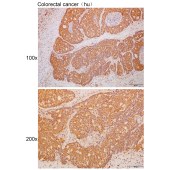 Solarbio K111687P Anti-DNASE1L2 Polyclonal Antibody
