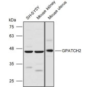 Solarbio K111247P Anti-GPATCH2 Polyclonal Antibody