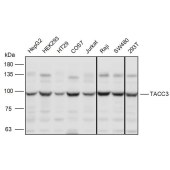 Solarbio K111119P Anti-TACC3 Polyclonal Antibody