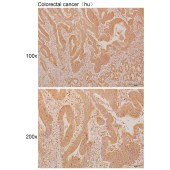 Solarbio K110912P Anti-DRC3 Polyclonal Antibody