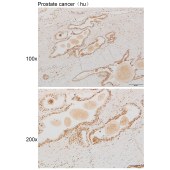 Solarbio K111866P Anti-Smad9 Polyclonal Antibody