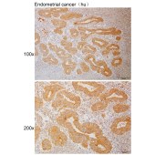 Solarbio K111096P Anti-ITGB3 Polyclonal Antibody