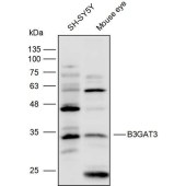 Solarbio K111763P Anti-B3GAT3 Polyclonal Antibody