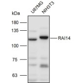 Solarbio K110976P Anti-RAI14 Polyclonal Antibody