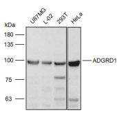 Solarbio K111302P Anti-ADGRD1 Polyclonal Antibody