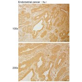 Solarbio K110976P Anti-RAI14 Polyclonal Antibody