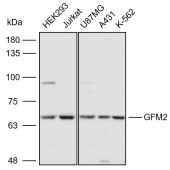 Solarbio K110904P Anti-GFM2 Polyclonal Antibody