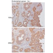 Solarbio K111494P Anti-ADAM17(Cleaved-Arg215) Polyclonal Antibody