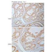 Solarbio K110899P Anti-NOC2L Polyclonal Antibody