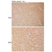 Solarbio K111058P Anti-HDAC10 Polyclonal Antibody