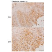Solarbio K110913P Anti-JAKMIP2 Polyclonal Antibody