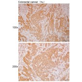 Solarbio K112098P Anti-TPK1 Polyclonal Antibody