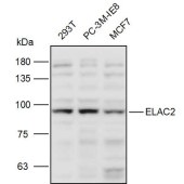 Solarbio K111127P Anti-ELAC2 Polyclonal Antibody