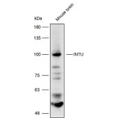 Solarbio K111688P Anti-INTU Polyclonal Antibody