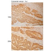 Solarbio K110957P Anti-PPIL3 Polyclonal Antibody