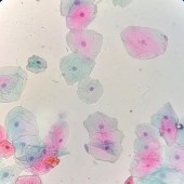 Solarbio G1612 巴氏染色试剂盒(EA36)
