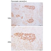Solarbio K110612P Anti-ADAT1 Polyclonal Antibody