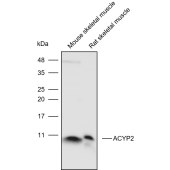 Solarbio K110569P Anti-ACYP2 Polyclonal Antibody