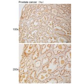 Solarbio K111115P Anti-PARP1 (Cleaved-Gly215) Polyclonal Antibody