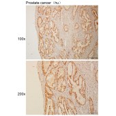 Solarbio K110983P Anti-SH3BP4 Polyclonal Antibody