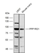 Solarbio K111746P Anti-PPP1R21 Polyclonal Antibody
