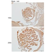 Solarbio K111462P Anti-GALNT17 Polyclonal Antibody