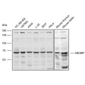 Solarbio K110580P Anti-ABI3BP Polyclonal Antibody