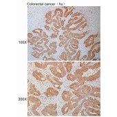 Solarbio K110911P Anti-RSPH3 Polyclonal Antibody