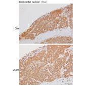 Solarbio K111476P Anti-HSD17B11 Polyclonal Antibody