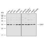 Solarbio K110588P Anti-CDK7 Polyclonal Antibody