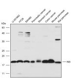 Solarbio K111619P Anti-INS Polyclonal Antibody