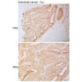 Solarbio K110991P Anti-AKT2 Polyclonal Antibody