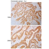 Solarbio K110907P Anti-ACAD11 Polyclonal Antibody