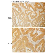 Solarbio K111051P Anti-HSPA14 Polyclonal Antibody