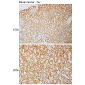 Solarbio K111092P Anti-ZNF337 Polyclonal Antibody