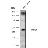 Solarbio K111042P Anti-TM4SF1 Polyclonal Antibody