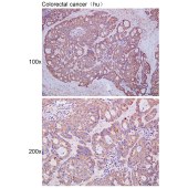 Solarbio K111669P Anti-FAAH2 Polyclonal Antibody