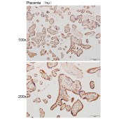 Solarbio K111032P Anti-DNAJC24 Polyclonal Antibody