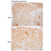 Solarbio K110577P Anti-PIP4K2B Polyclonal Antibody