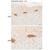 Solarbio K111445P Anti-PTPN22 Polyclonal Antibody