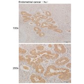 Solarbio K111230P Anti-ST3GAL3 Polyclonal Antibody