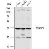 Solarbio K110553P Anti-DTNBP1 Polyclonal Antibody