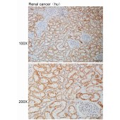 Solarbio K110934P Anti-ARMC5 Polyclonal Antibody