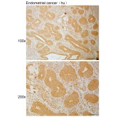 Solarbio K111033P Anti-CAPN7 Polyclonal Antibody