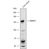 Solarbio K111772P Anti-MMRN1 Polyclonal Antibody