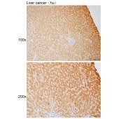 Solarbio K111904P Anti-CREB3 Polyclonal Antibody