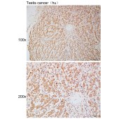 Solarbio K111906P Anti-ROPN1L Polyclonal Antibody